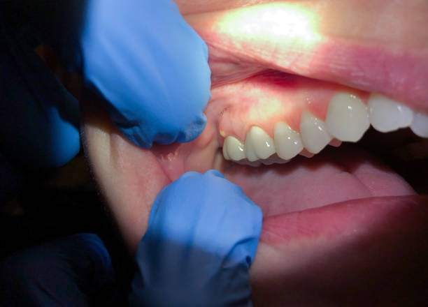 Best Pediatric Emergency Dentist in Great Falls Crossing, VA